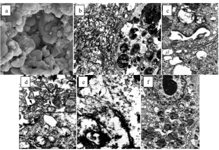 Figure 3. microscopy, clusters of PDL cells, with secreted ECM. (b-f): Transmission electron microscopy; (b) A PDL cell 