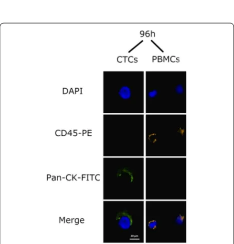 Fig. 10 Immunocytochemical analysis of CTCs that were isolated from the samples using Pancytokeratin magnetic beads after 48 and 72 h