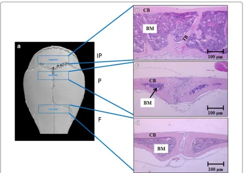 Fig. 2 Analysis of BM areas in calvarial bones of male C57BL/KalwRi‑JHsD mice. There was a significant increase in the BM volume in interparietal bones compared to frontal and parietal bones