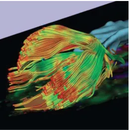 Figure 7. Screen capture of DTI image from 3DSlicer - Close up three-quarter view of tractography and brain ventricles displayed as volume models