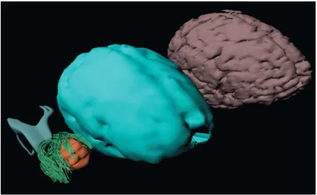 Figure 10. Screen capture of image from MAYA - Brain ventricle, tumor and Diffusion Tensor Tractography (DTI) data – Prototype model