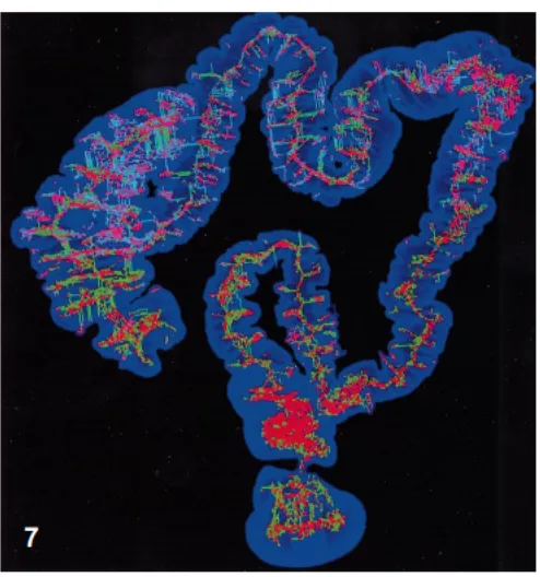 Figure 4: Skeleton extraction used for centerline generation in colon image. Image taken from
