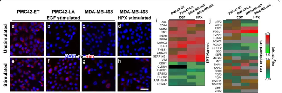 Figure 1 Stimulation of PMC42-ET and PMC42-LA cells with EGF, or stimulation of MDA-MB-468 cells with EGF or growth under hypoxic conditions((HPX) promotes a mesenchymal phenotype