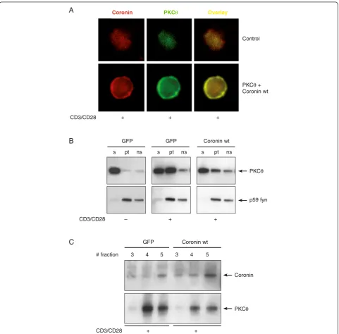 Figure 3 Coro1A modulates PKCθ-mediated subcellular location in activated T cells. Jurkat cells were transfected with GFP inert proteincontrol, PKCθ or Coro1A wild-type cDNA expression plasmids, respectively