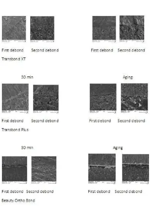 Figure 6. Resin-enamel interface in the studied groups at ×3000 magniﬁcation.Note the gap at the resin-enamel interface in the Beauty Ortho Bond group in theﬁrst and second bonds