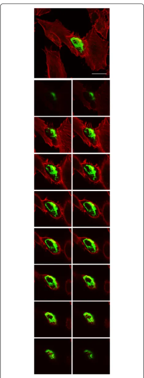 Figure 6 Ectopic expression of BtpA in HeLa cells inducesfilopodia. HeLa cells were transiently transfected with plasmidsencoding GFP-BtpA