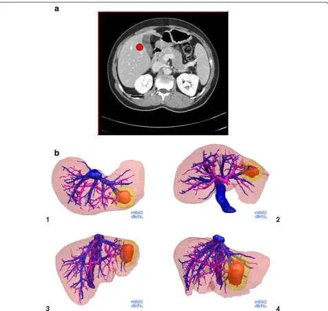 Figure 2 a Screenshot showing the TM for 2D+. A regular CT movie was presented as consecutive transverse slices