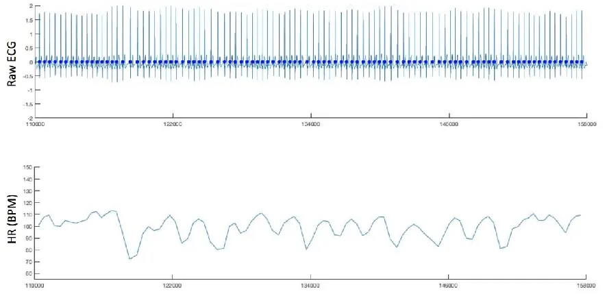 Figure S1 shows an illustrative plot of the data visualisations used to perform manual setting of the thresholds for ECG data parsing, and for post hoc checking of the accuracy of the results