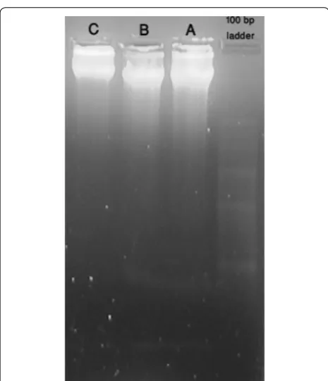 Fig. 9 UV-Illumination of fragmented DNA bands of ZnO NPs and modified ZnO NPs treated cells in 1.2 % Agarose gel along with control untreated cells (leftmost) and 100 bps ladder (rightmost) segregated on 5 V/cm for 2 h