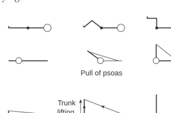 Fig. 2 Ratio of trunk lifting to vertebral compression forces due to the pull of iliopsoas in a sit-up.