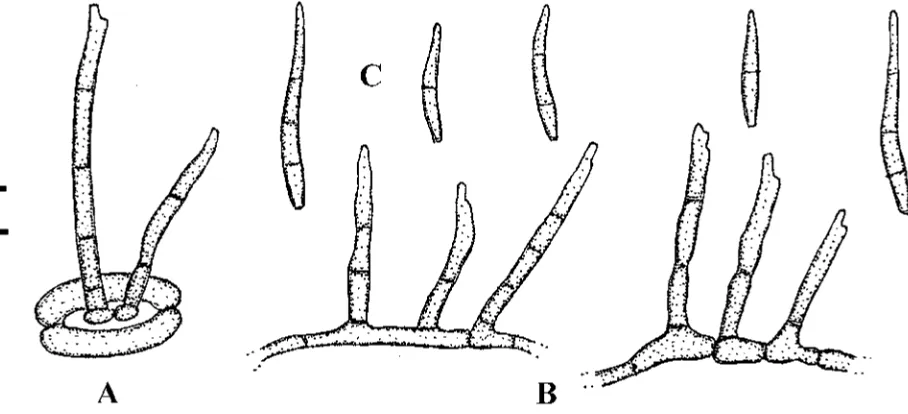 Fig. 40. Pseudocercospora lygodii (NTU-PPE, holotype). A. Small conidiophore fascicle