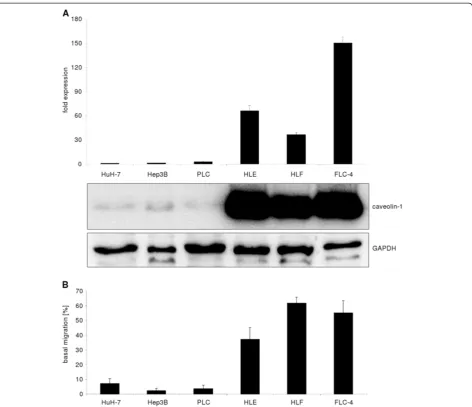 Figure 7 HCC cell lines and caveolin-1 expression.Based on elevated basal migration capacity, assessed with the transwell assay, HLE, HLF and FLC-4 are considered dedifferentiated (see text for (A) HUH-7, Hep3B and PLC/PRF/5 are weak caveolin-1 expressing 