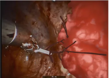 Fig. 3. An early version of a Surgery 1 step, emphasizing the details of the blood on the tissue