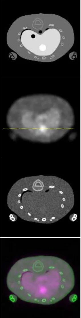 Fig. 7. Top to bottom show: 1) the image of multiple 22and 2) measured resolutions along radial, tangential, and axial directions with different DOI measurement resolutions, from 0.0 mm (perfect DOI measurement capability), to 2.0 and 5.0 mm
