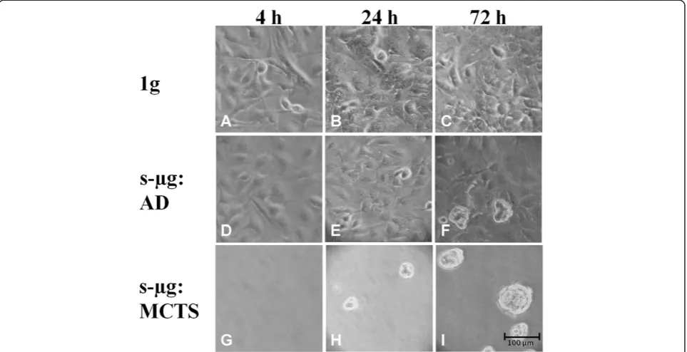 Figure 1 Phase-contrast microscopy of FTC-133 after culturing on the CN or as corresponding 1g control