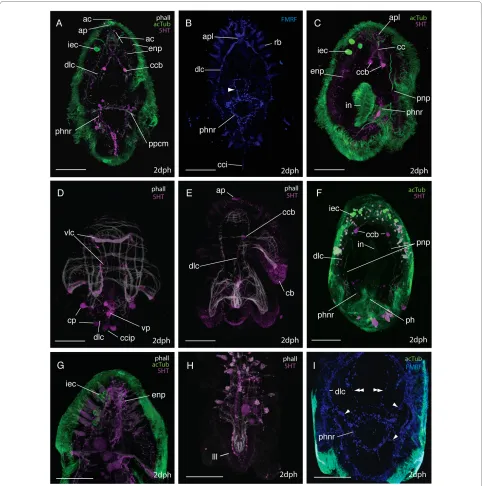 Figure 6 CLSM micrographs of the nervous system in two-day post-hatching RFamide expression in the apical plexus (Rhabdites (the spatial relationships between the intra-epidermal cells, epidermal nerve plexi, pharyngeal nerve ring, protonephridia (& E) ta,