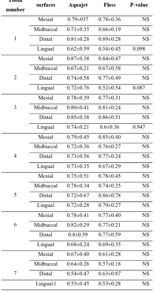 Table 6- Pre and post-cleaning plaque reduction scores (Mean±standard deviation) in mandibular teethafter using Aquajet and dental ﬂoss