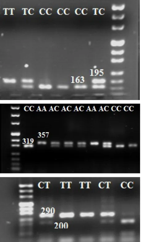 Figure 1. (A) Enzymatic digestion for the 195 bp fragment of PPARGC1A gene: TT (195 bp), CC (163 and 32 bp), TC (195, 163, and 32 bp); (B) enzymatic digestion for the 357 bp fragment of PPARGC1A gene: AA (357 bp), CC (319 and 38 bp), AC (357, 319, and 38 b