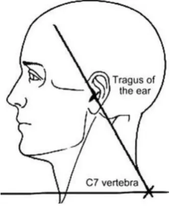 Fig. 1.Side Pose of a Person to Find the Craniovertebral Angle.