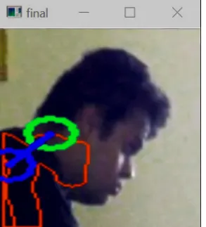 Fig. 2.Identifying the points of interest for ﬁnding out craniovertebralangle