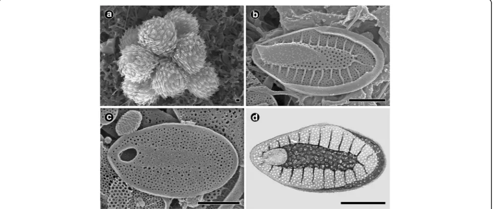 Fig. 1 Morphology of the colony and scales ofTop surface of a body scale. Synura americana (a–c: SEM, d: TEM)