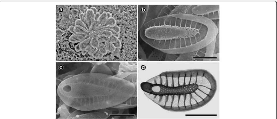 Fig. 3 Morphology of the colony and scales of Synura truttae (a–c: SEM, d: TEM). All scale bars, 1 μm