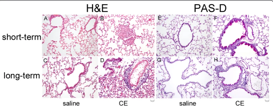 Figure 3 Histological analysis of mice sensitized to cockroach allergens. Representative pictures from mice sensitized under the short termprotocol (A, B, E and F) and long-term protocol (C, D, G and H) are shown
