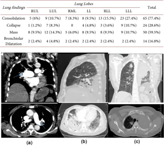Table 1. Distribution of lung lesions on CT chest. 