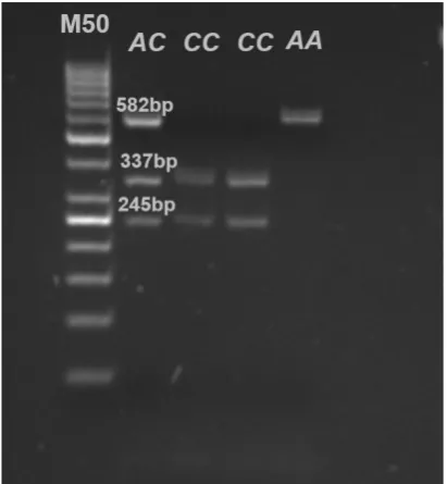 Figure 1. PCR-RFLP patterns of bovine OLR1 gene