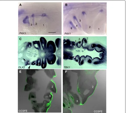 Fig. 2 The generation and remodelling of the pharyngeal segments. a Side view of a HH17 chick embryo, the three fully formed anterior archescan be seen while at HH21 (b) the full complement of arches have formed