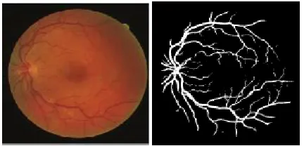 Fig 6  (a)Original Image  (b)Segmented Image     