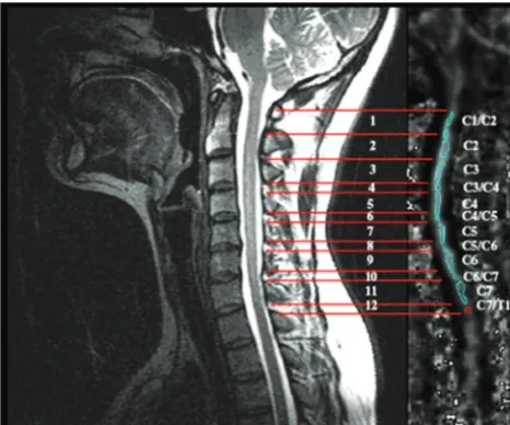 Fig 1. Sagittal T2WI of the cervical spinal cord from a healthy volunteer demonstrating themethod of region-of-interest selection and relative spinal levels.
