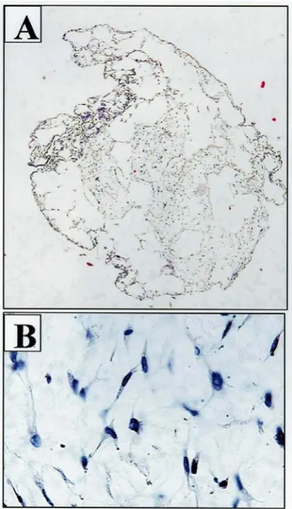 Figure 2: Decalcified scaffolds contained the loaded MSCs A: magnification 10× and B) magnification 200× 