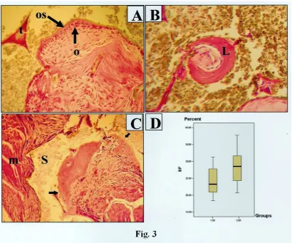 Figure 3: Representative histomicrograph of the bone formation within the muscle tissue