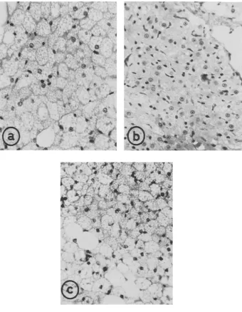 Fig. 2: Photographs of sections of interscapular brown fat taken (a) 260 C and from an adult rat kept at (b) a littermate aPcer exposure to cold (60 C) for 12 hours and (c) a comparable rat aPcer 24 hours exposure to cold (60 C); Masson's trichrome × 750
