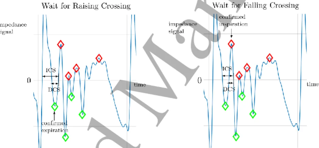 Figure 1. Illustration of the zero-crossing algorithm with Identical Crossing Spacing (ICS) and Different Crossing  Spacing  (DCS)  indicated  in  the  breath  (impedance)  signal