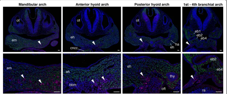 Fig. 3 Trajectory of HBM precursors in mouse embryos. Transverse sections of mandibular, hyoid and branchial arch levels in Wnt1-Cre/R26R-H2B-EGFP embryos at stage E10.5