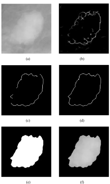 Table 1. Features extracted from microcalcification clusters.
