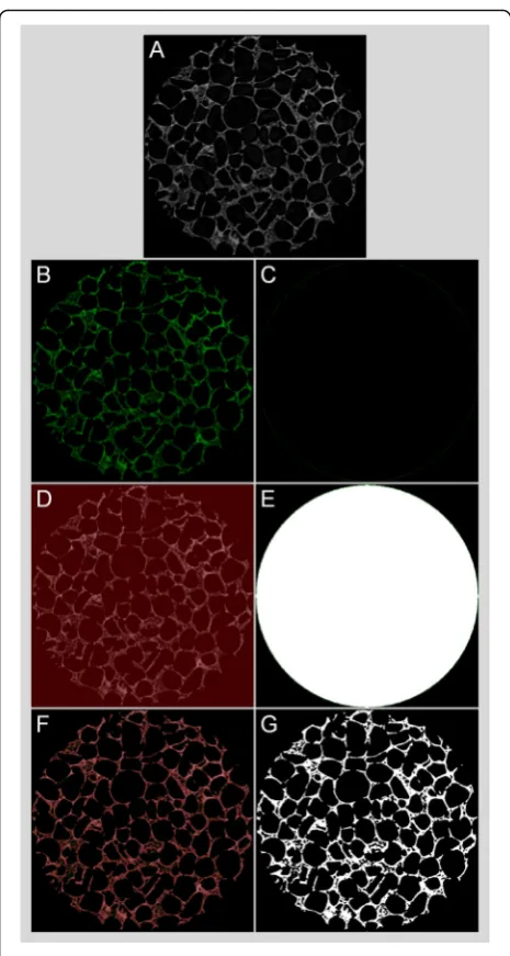 Fig. 3 Binarization of reconstructed micro-CT images. Gray-scalerespectively if no gray-scale value is included that yields to completeblack, if entire gray-scale values are included that yields to completewhite, and if the right gray-scale values (that is in this case 38-255) areobtained by global thresholding that yields to a binary image showing(reconstructed 2D image of a silk-based tissue engineering scaffoldwith a circular region of interest (ø 3 mm) (a), half-tone viewsb, d, and f) and the corresponding binary images (c, e, and g)the microstructure of the scaffold