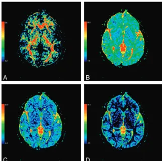 Fig 3. The color-coded FA (A), �1 (B), �2 (C), and �3 (D) mapsat the level of the basal ganglia (,,: 10�4 mm2/s).