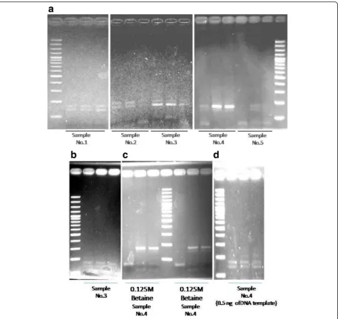 Fig. 5 Effect of the modified HER2 Ile655Val AS-PCR on preferential PCR amplification.errors-showing patients with breast cancer.c a; Screening of AG genotype samples of genotyping b; AS-PCR product of sample No.3 after modifying the denaturation temperatu
