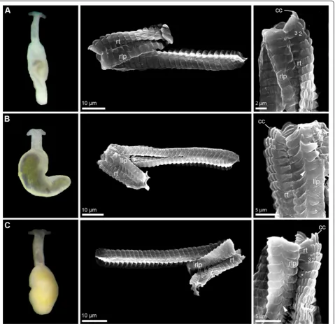 Figure 1 External morphology (living specimens) and radula characteristics (SEM micrographs) inliliae Pontohedyle species (part 1).A) Pontohedyle kepii sp