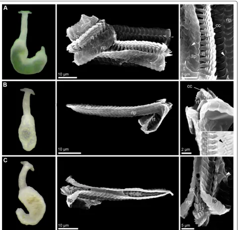 Figure 2 External morphology (living specimens) and radula characteristics (SEM micrographs) in(holotype), radula from IP-2, see [25]); Pontohedyle species (part 2).A) Pontohedyle peteryalli sp