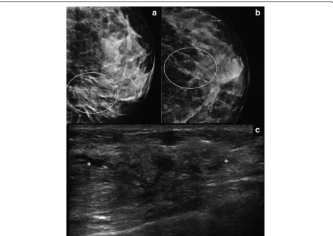 Table 6 Correlation between presence of calcifications atmammography and molecular subtypes (n = 87)