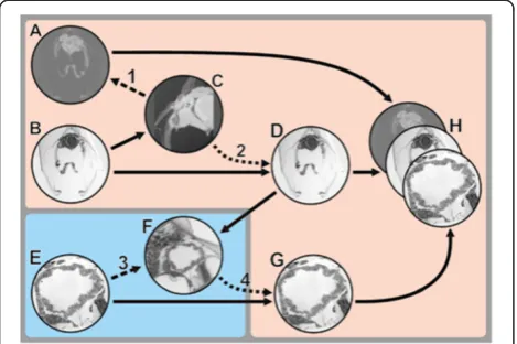 Figure 4 Workflow of TEM section 3D registration. A. MicroCTstack. B. LM image stack. C