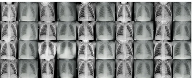 Fig. 2 Generated images from CycleGAN for the underrepresented COVID-19 class