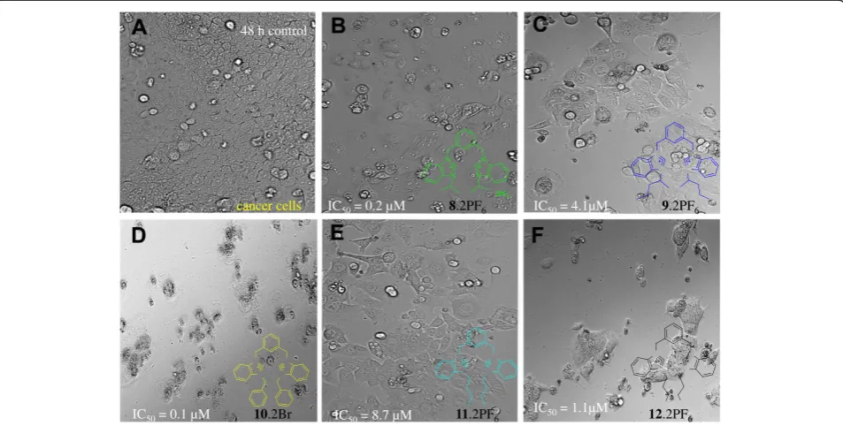 Figure 8 HCT116 cell images were taken under an invented phased-contrast microscope at ×200 magnification with a digital cameraat 48 hours after treatment with the samples