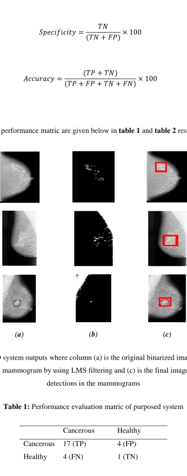 Figure 3: proposed CAD system outputs where column (a) is the original binarized image to be processed, (b) is  the adaptively enhanced mammogram by using LMS filtering and (c) is the final image output after distortions 