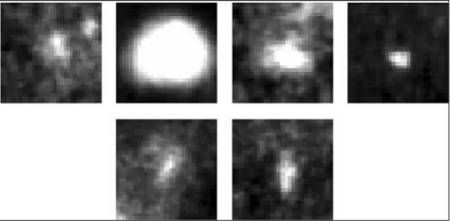 Figure 2.3 Images of 1mm x 1mm vignettes containing individual MCs from benign clusters [11] 
