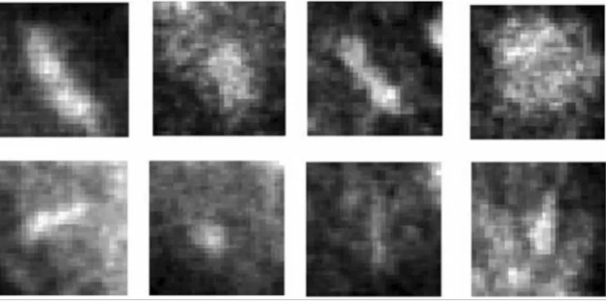 Figure 2.4 Images of 1 mm x 1 mm vignettes containing individual MCs from malignant clusters [11] 